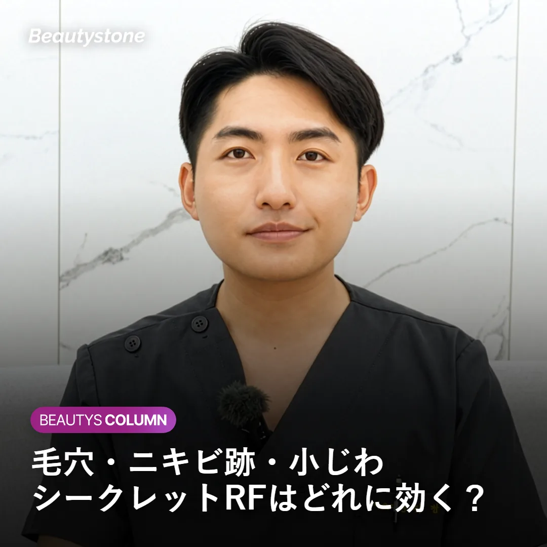 毛穴・ニキビ跡・小じわとシークレットRFの関係を示すイメージ