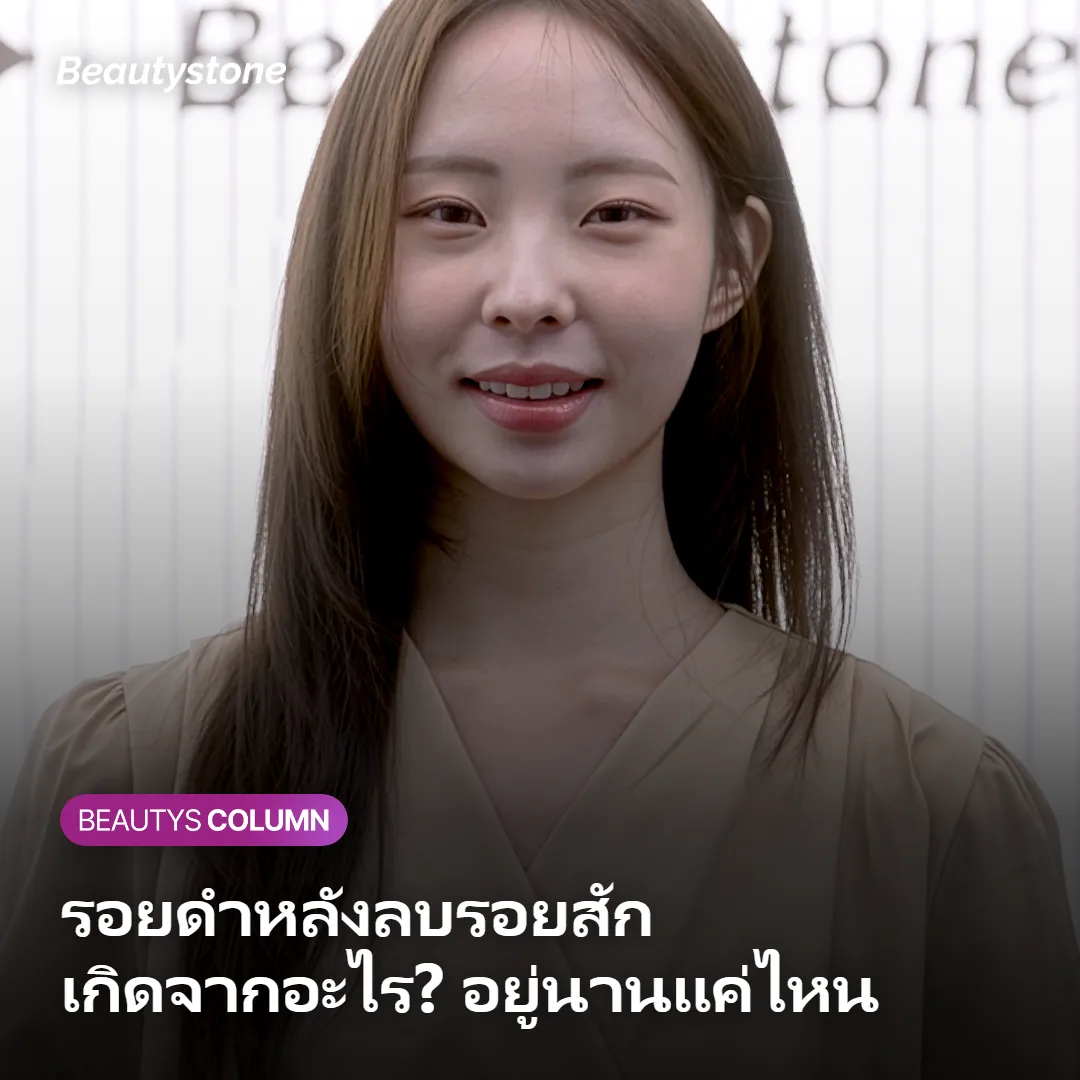ภาพแสดงสาเหตุและแนวทางการดูแลรอยดำหลังลบรอยสัก