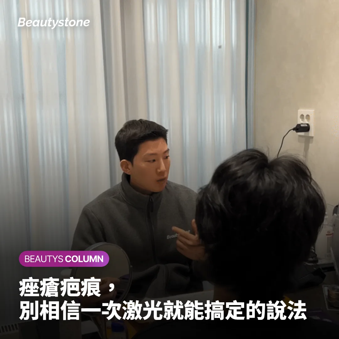 痤瘡疤痕,別相信一次激光就能搞定的說法