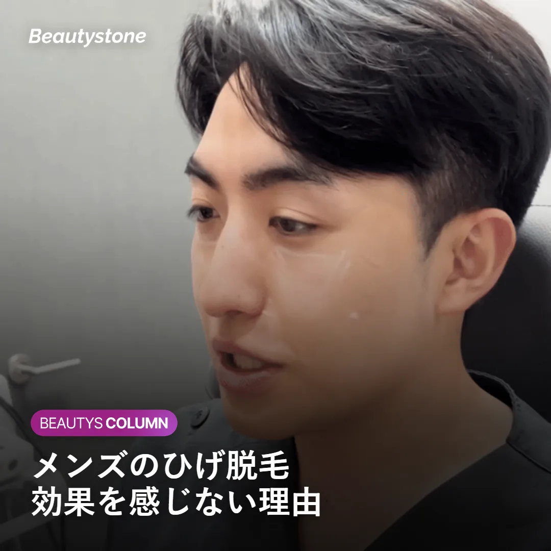 メンズのひげ脱毛について解説するイメージ