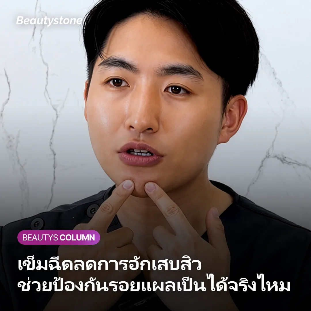 ภาพประกอบบทความเข็มฉีดลดการอักเสบสิว ช่วยป้องกันรอยแผลเป็นได้จริงไหม