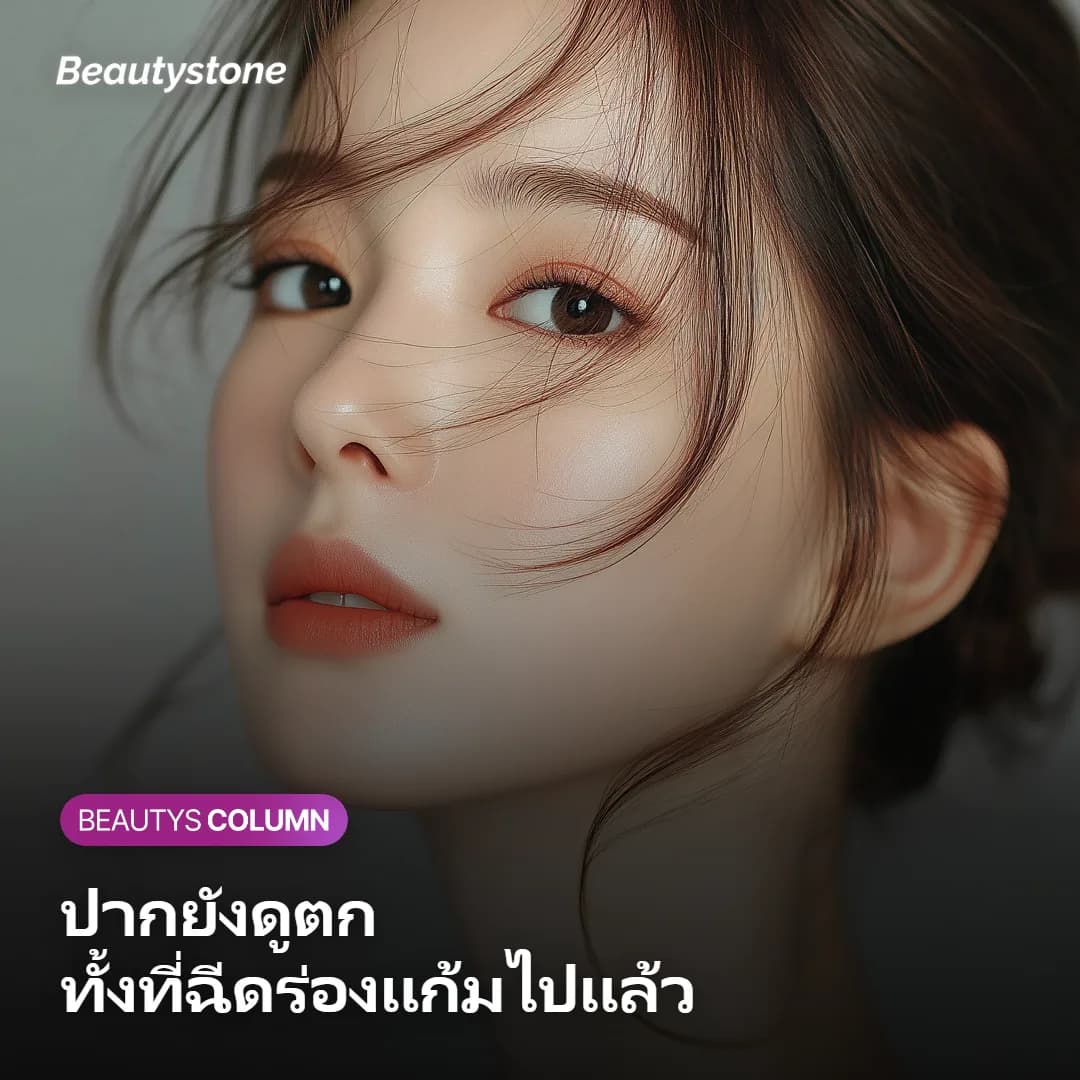 ภาพผู้หญิงกำลังส่องกระจกดูปากที่ยังดูตกแม้ฉีดร่องแก้มไปแล้ว