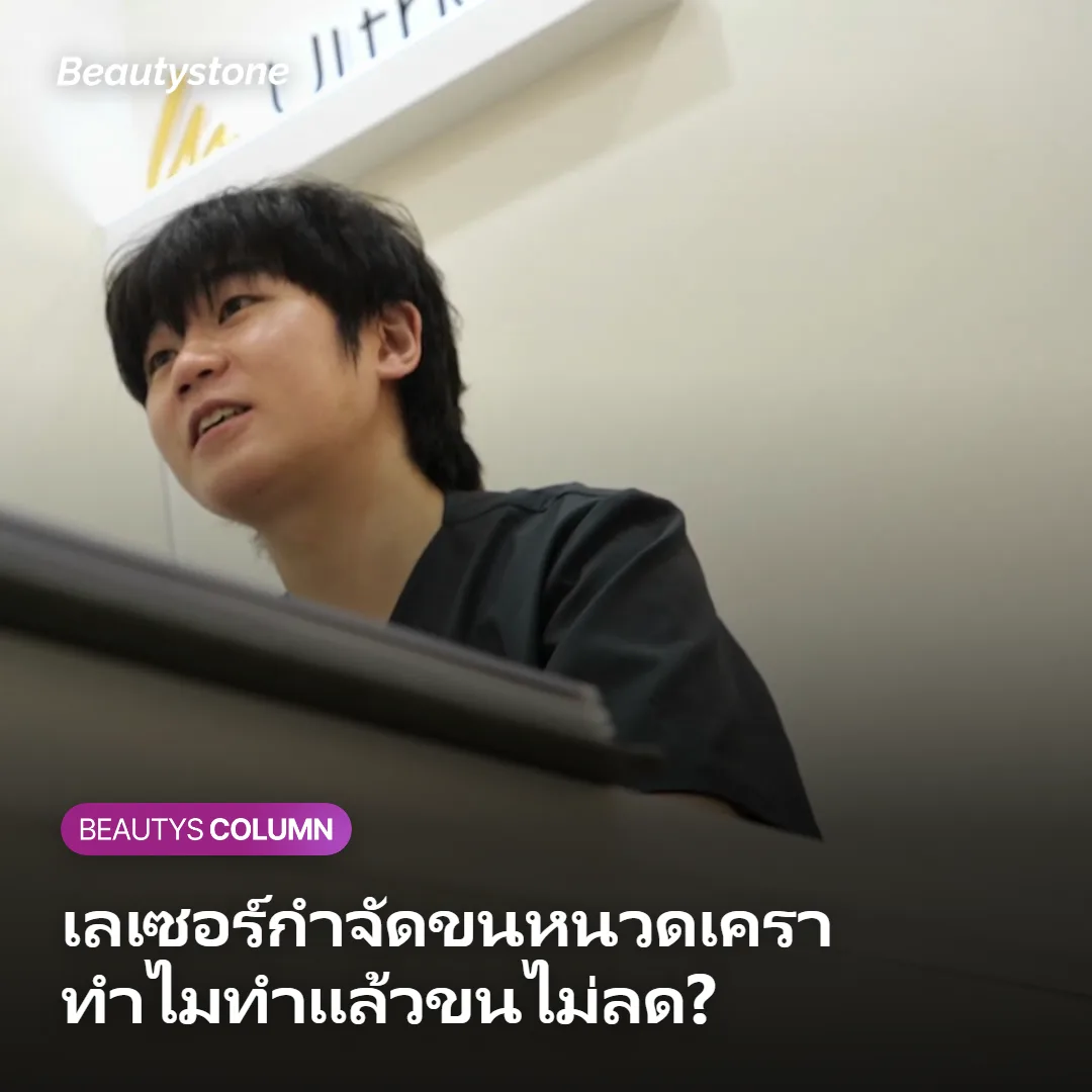 ภาพประกอบเลเซอร์กำจัดขนหนวดเคราผู้ชาย