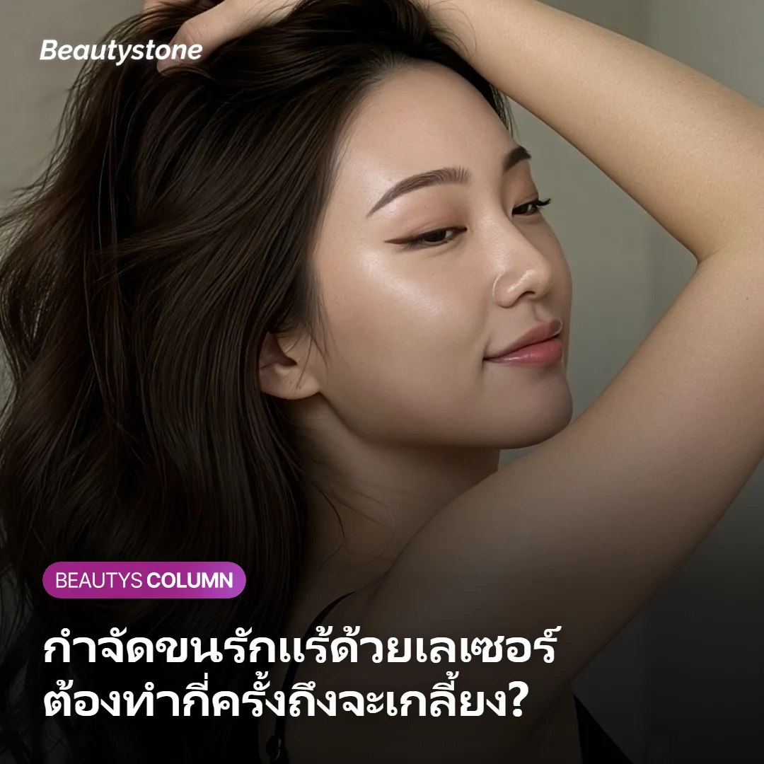 กำจัดขนรักแร้ด้วยเลเซอร์ ต้องทำกี่ครั้งถึงจะเกลี้ยงจริง?