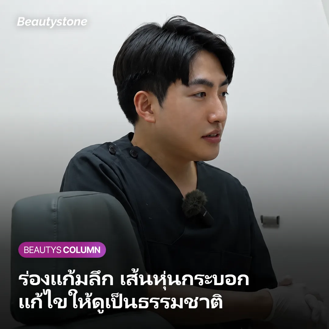 ภาพประกอบการดูแลร่องแก้มลึกและเส้นหุ่นกระบอกด้วย Sculptra