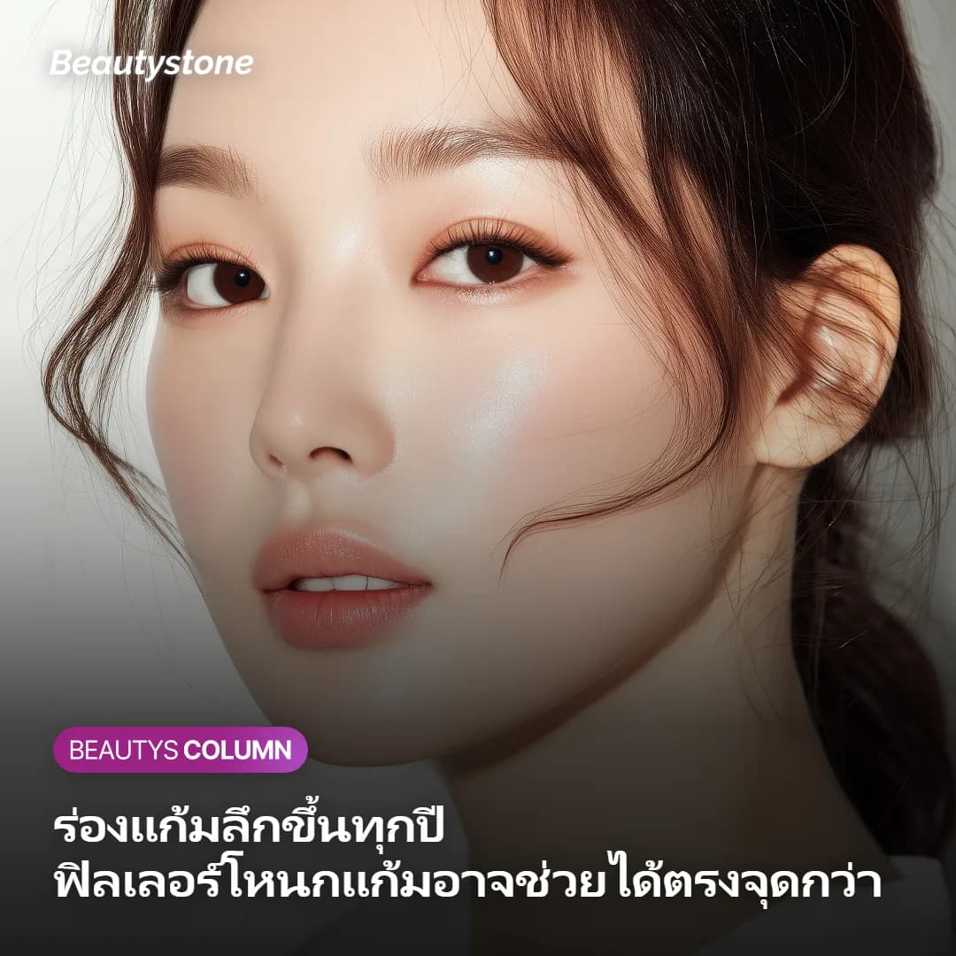 ภาพแสดงหลักการฉีดฟิลเลอร์โหนกแก้มเพื่อช่วยให้ร่องแก้มตื้นขึ้น
