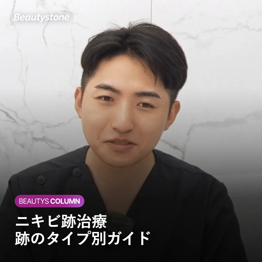 ニキビ跡の治療法をタイプ別に解説するイメージ