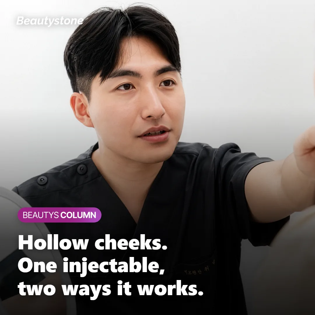 Juvelook Volume for Hollow Cheeks: Worth It?