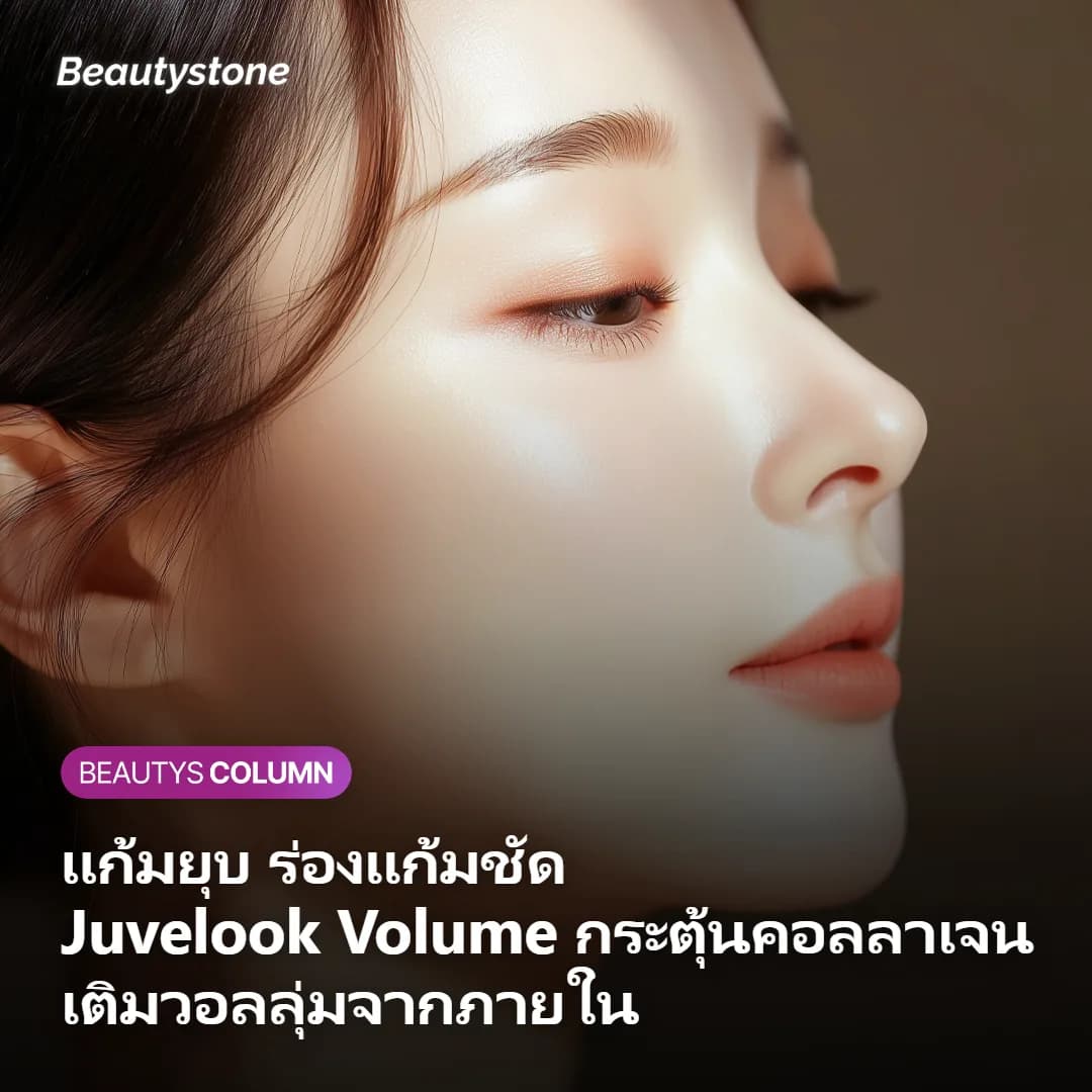 ผู้หญิงแก้มฟูเด้งหลังรับโปรแกรม Juvelook Volume