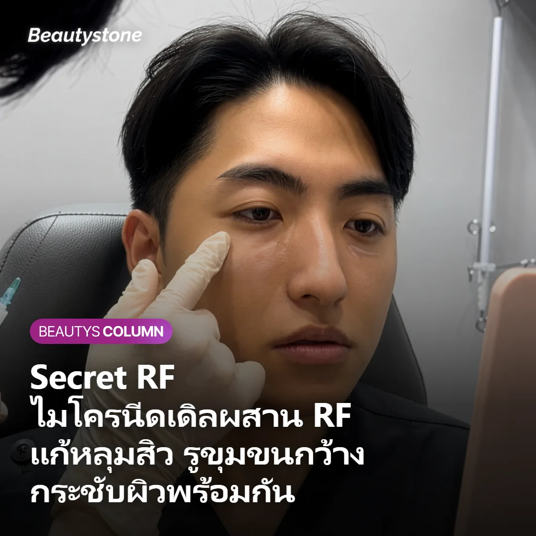 หัตถการ Secret RF ไมโครนีดเดิล RF ที่ BeautyStone Clinic กรุงโซล