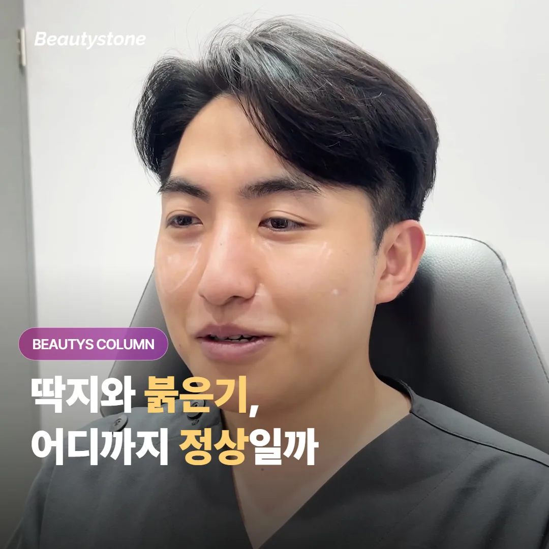 포텐자 후 딱지와 붉은기, 어디까지가 정상이고 언제 연락해야 할까요?