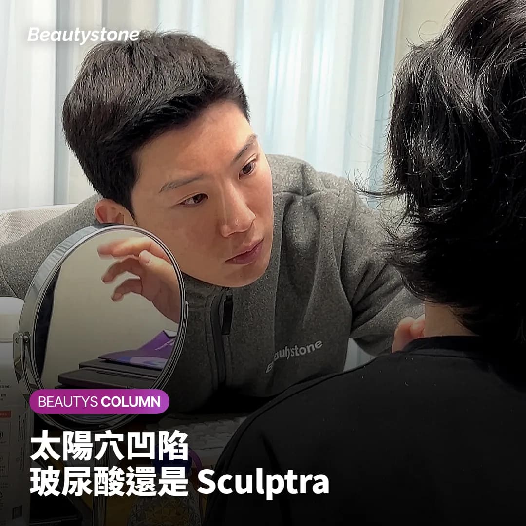 關於太陽穴凹陷該選玻尿酸還是 Sculptra 的封面圖