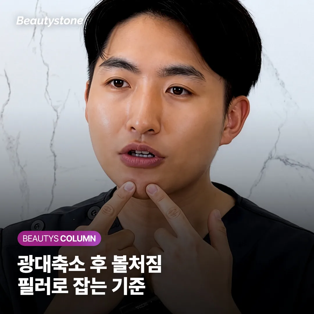 광대축소 후 볼처짐, 필러로 잡을 수 있을까요? 시술 선택 기준까지
