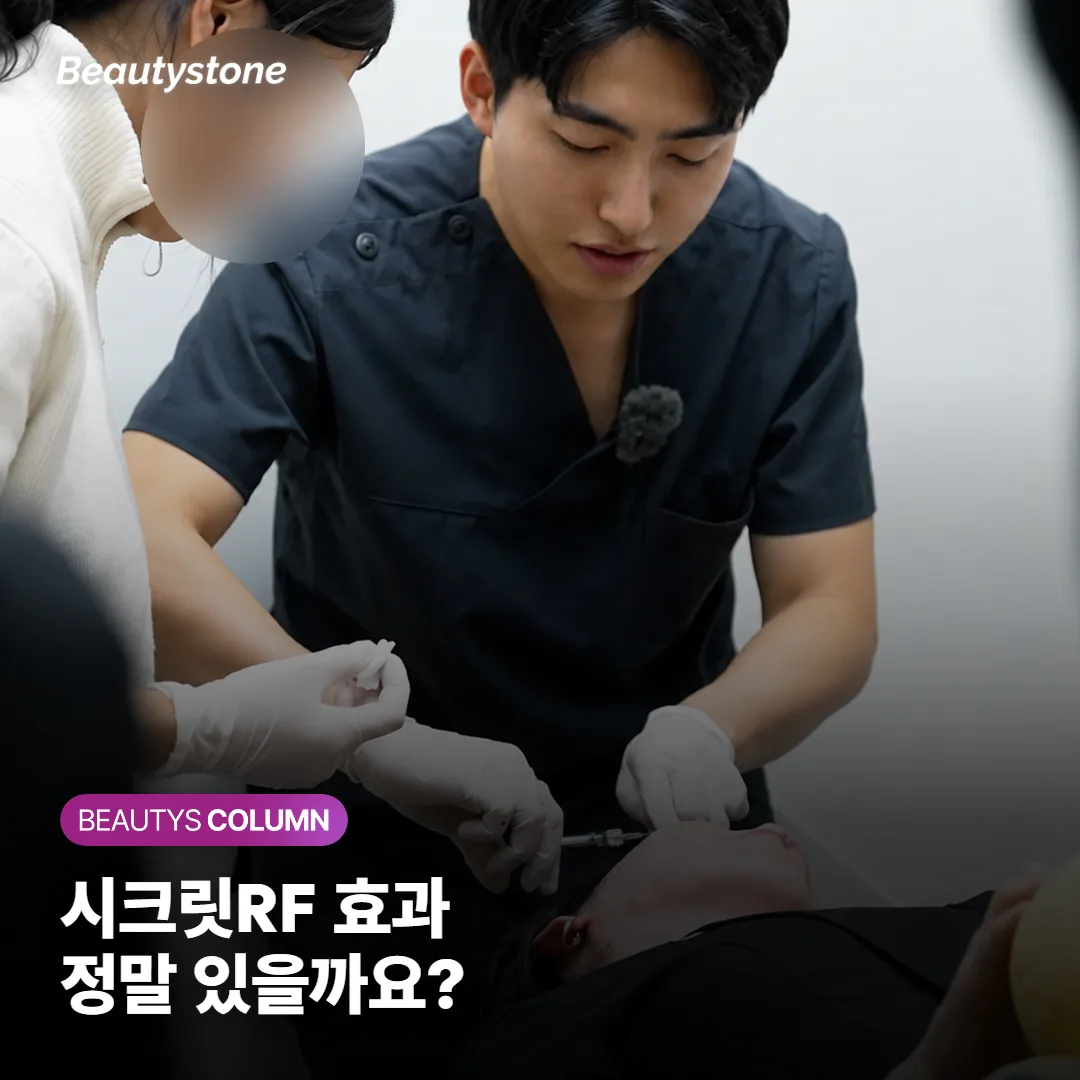 시크릿RF, 모공과 여드름 흉터에 정말 효과 있을까요? 통증·회복·횟수까지 한 번에