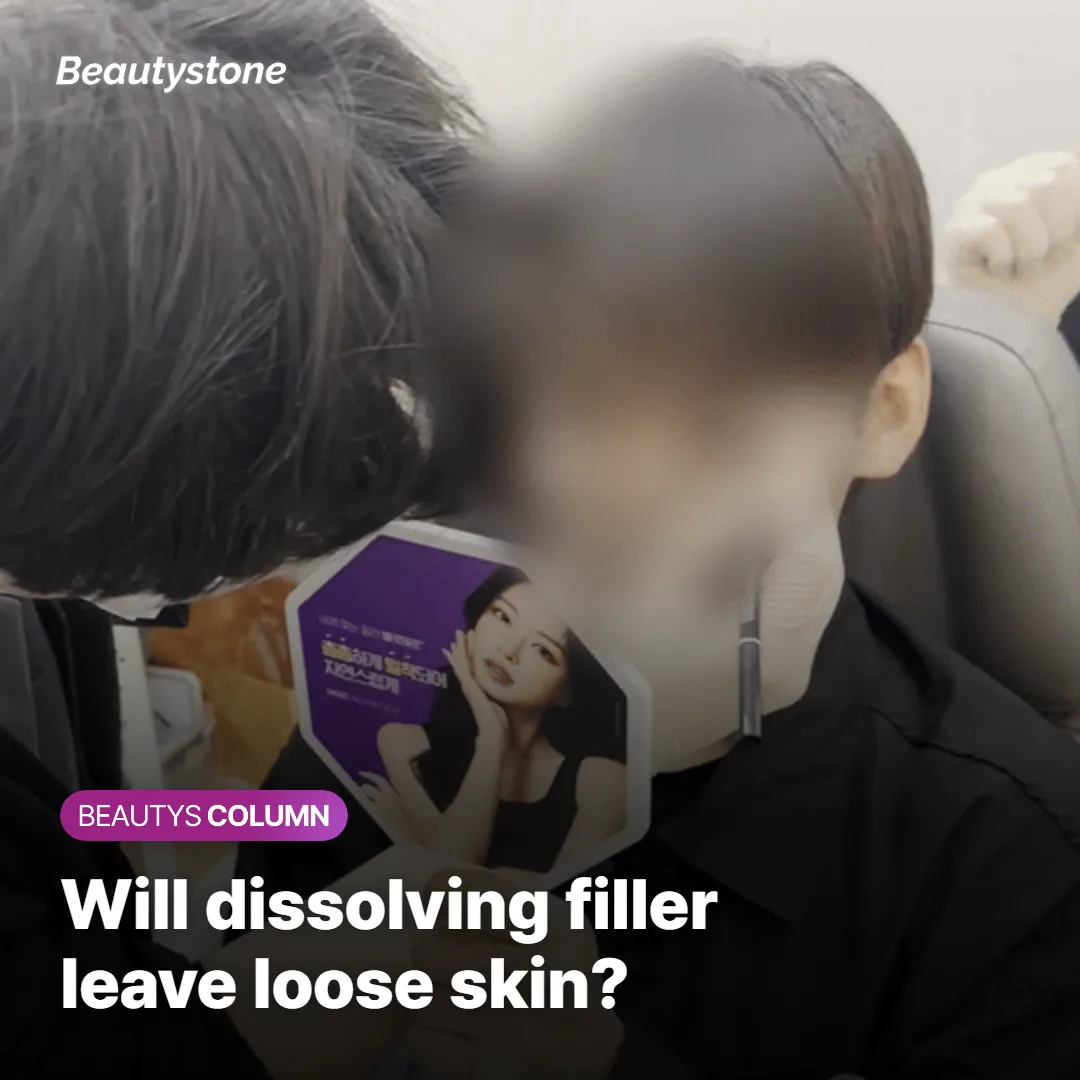 Patient consultation about dissolving hyaluronic acid filler and worries about sagging skin afterward