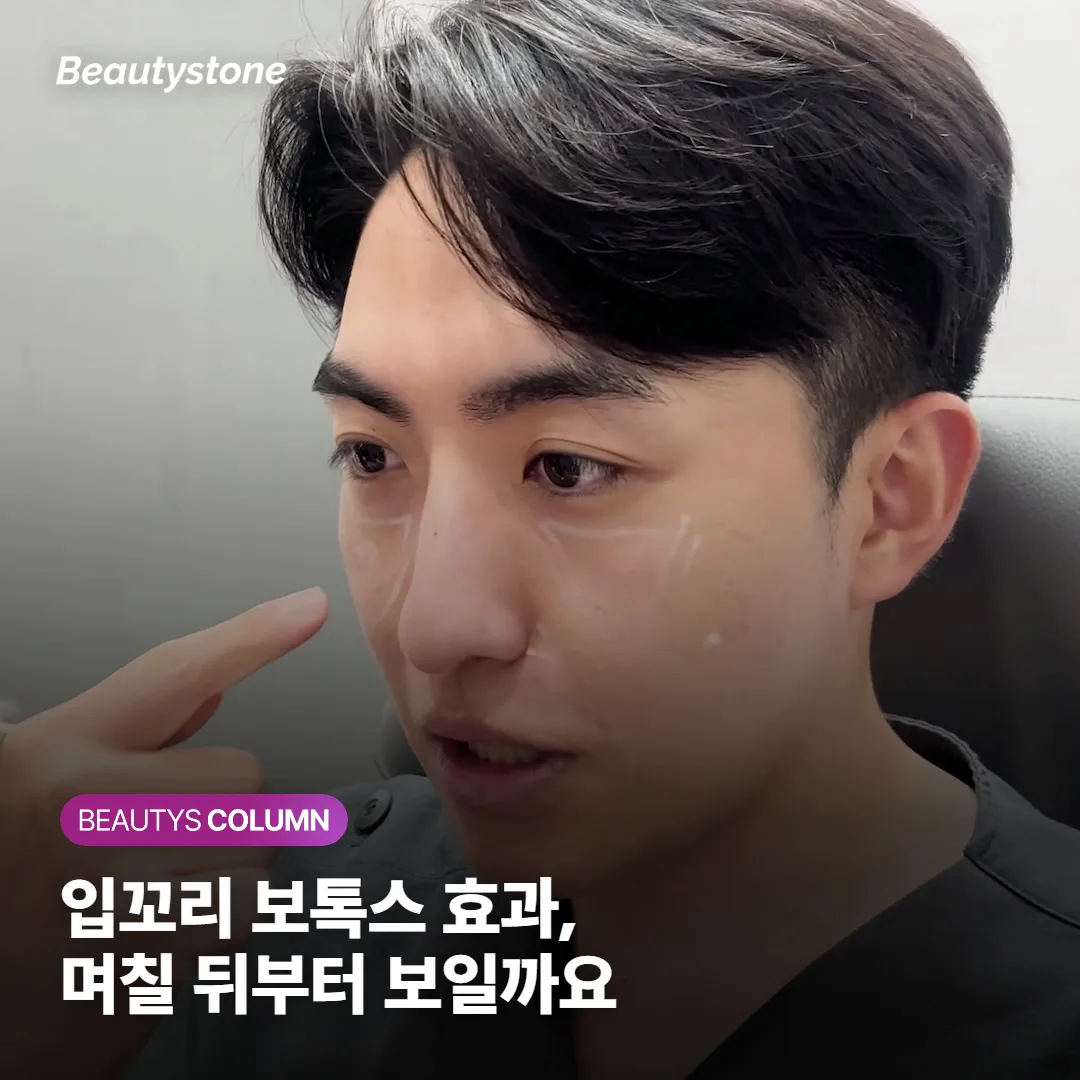 입꼬리 보톡스 효과, 며칠 뒤부터 보이고 얼마나 유지될까요