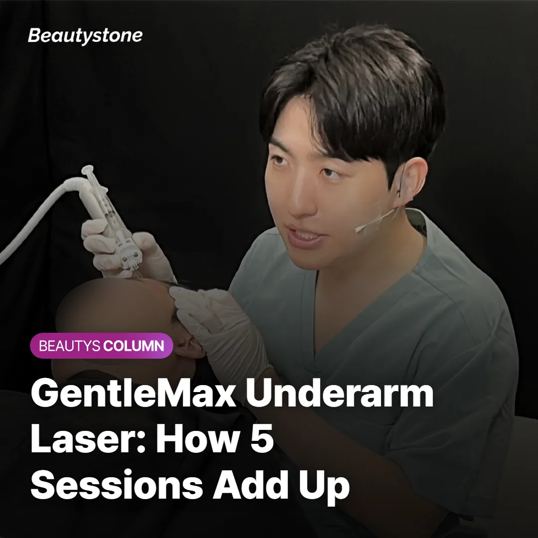 GentleMax Underarm Laser: How 5 Sessions Add Up