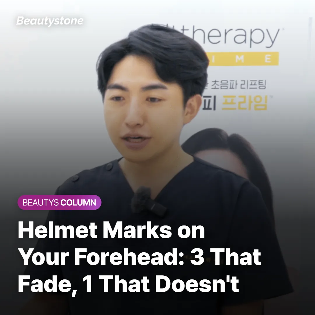 Helmet Marks on Your Forehead: 3 That Fade, 1 That Doesn't