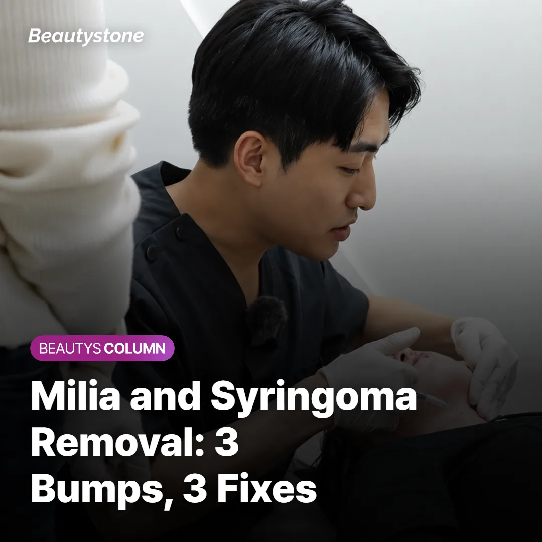 Milia and Syringoma Removal: 3 Bumps, 3 Fixes