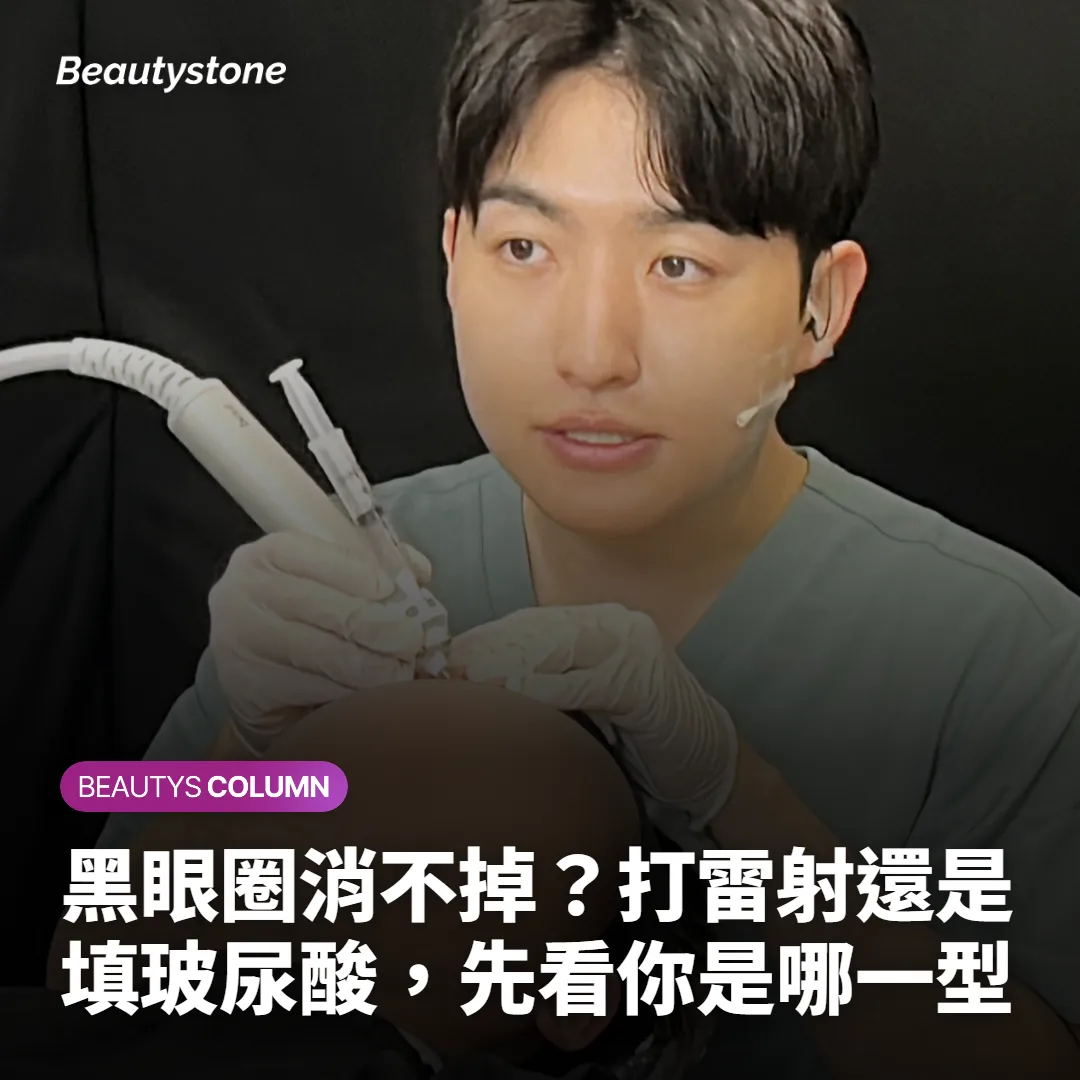 黑眼圈消不掉?打雷射還是填玻尿酸,先看你是哪一型