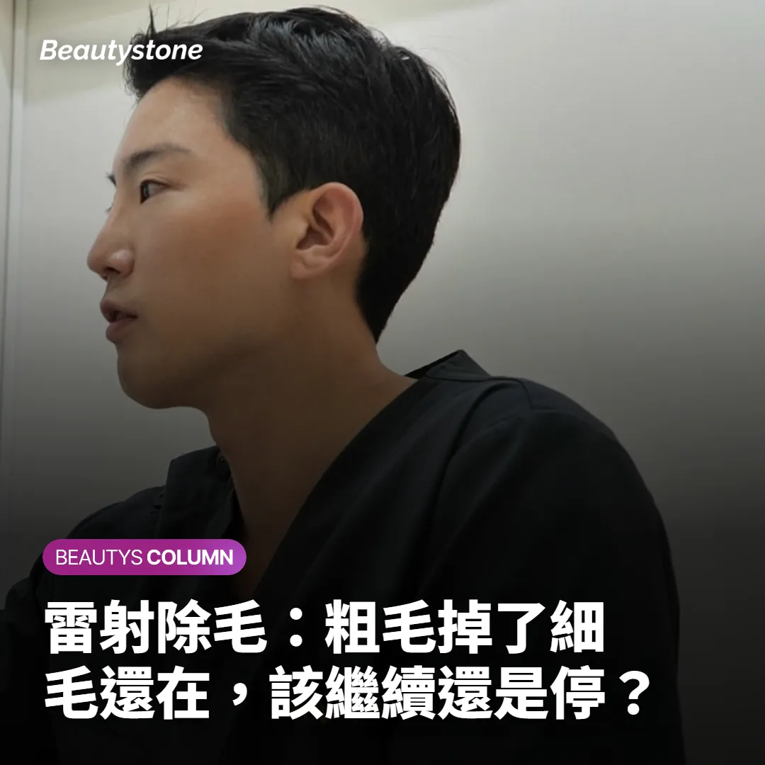 雷射除毛:粗毛掉了細毛還在,該繼續還是停?