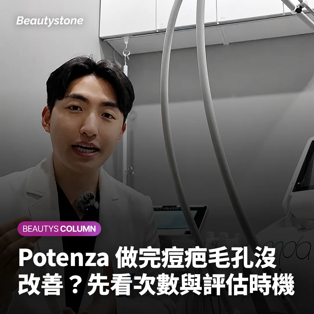 Potenza 做完痘疤毛孔沒改善?先看次數與評估時機
