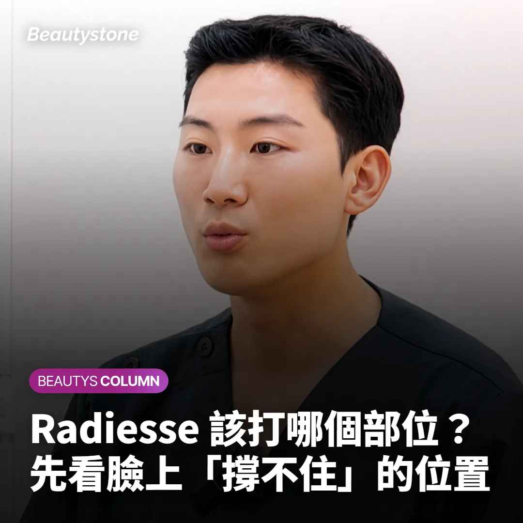 Radiesse 該打哪個部位?先看臉上「撐不住」的位置