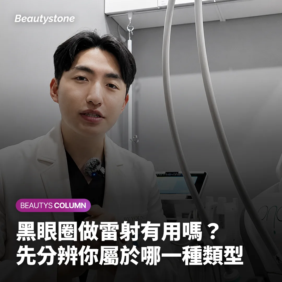 黑眼圈做雷射有用嗎?先分辨你屬於哪一種類型