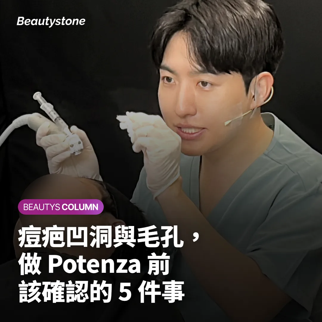 痘疤凹洞與毛孔,做 Potenza 前該確認的 5 件事