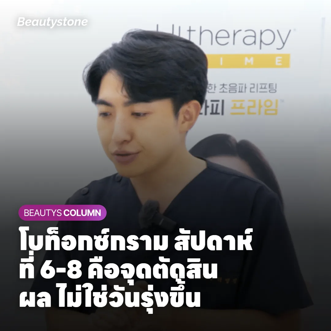 โบท็อกซ์กราม สัปดาห์ที่ 6-8 คือจุดตัดสินผล ไม่ใช่วันรุ่งขึ้น