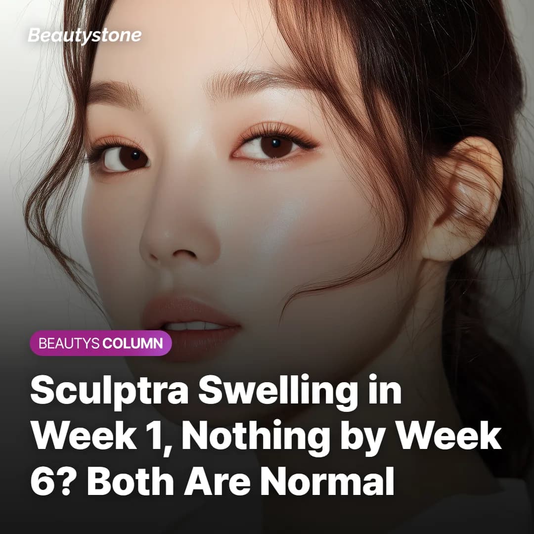 Sculptra Swelling in Week 1, Nothing by Week 6? Both Are Normal
