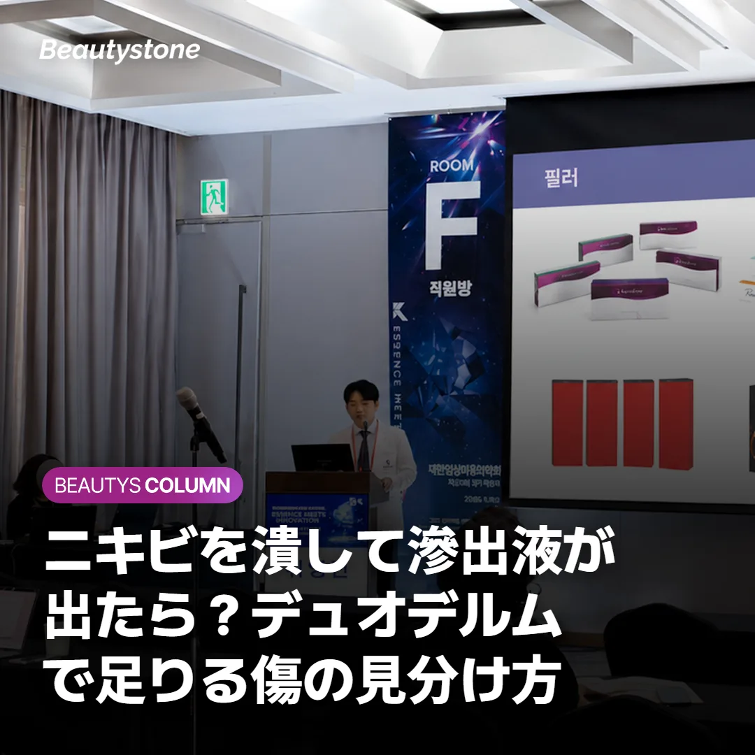 ニキビを潰して滲出液が出たら?デュオデルムで足りる傷の見分け方