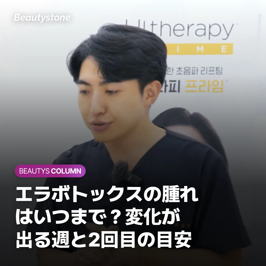 エラボトックスの腫れはいつまで?変化が出る週と2回目の目安