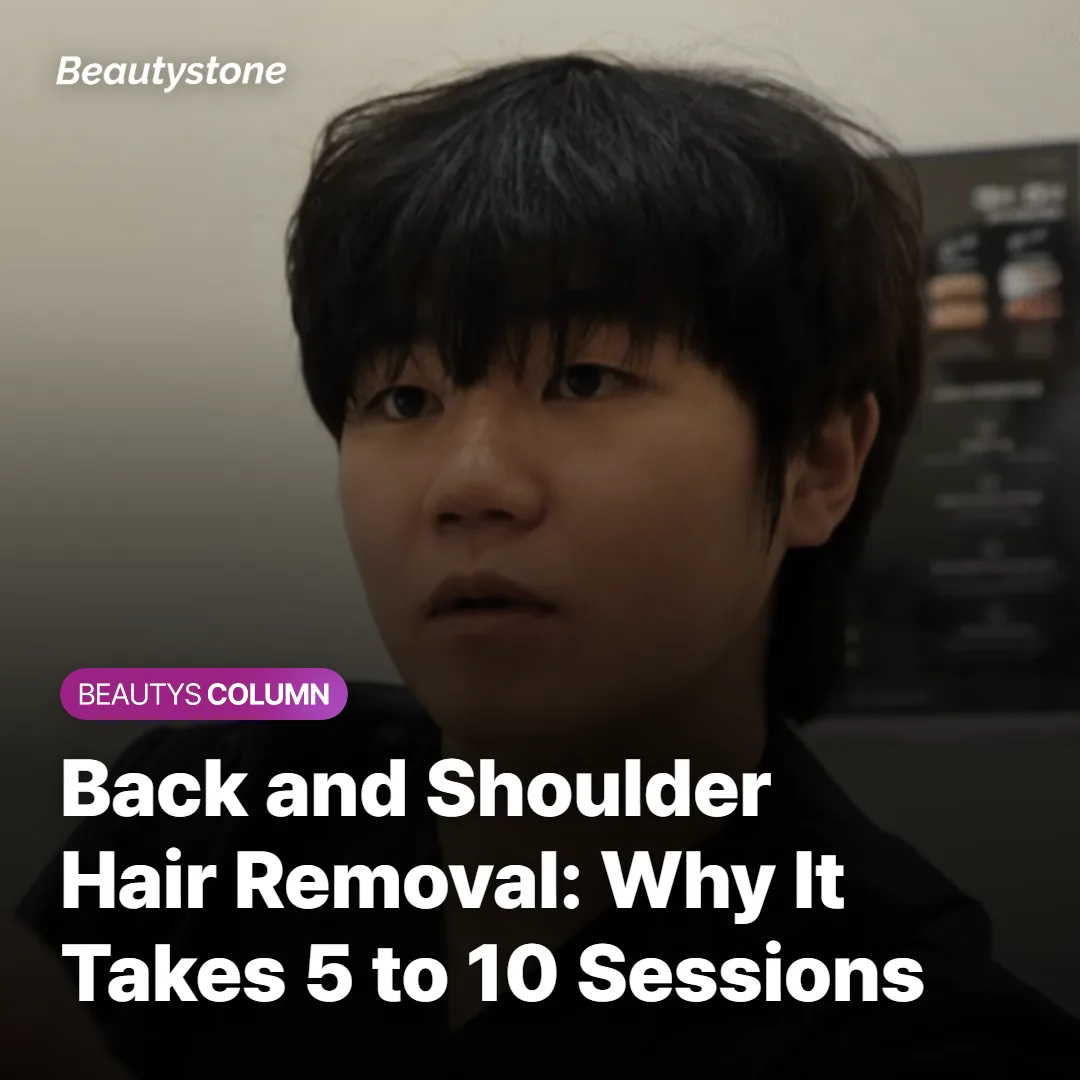 Back and Shoulder Hair Removal: Why It Takes 5 to 10 Sessions