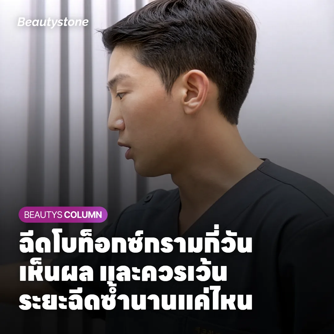 ฉีดโบท็อกซ์กรามกี่วันเห็นผล และควรเว้นระยะฉีดซ้ำนานแค่ไหน