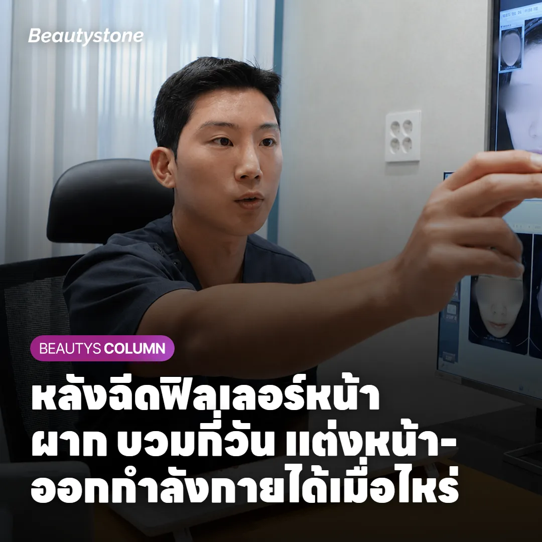 หลังฉีดฟิลเลอร์หน้าผาก บวมกี่วัน แต่งหน้า-ออกกำลังกายได้เมื่อไหร่