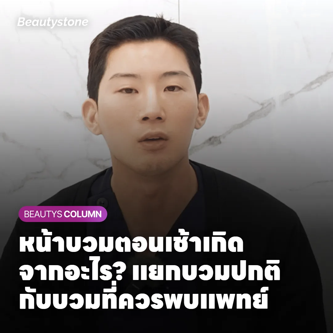 หน้าบวมตอนเช้าเกิดจากอะไร? แยกบวมปกติกับบวมที่ควรพบแพทย์