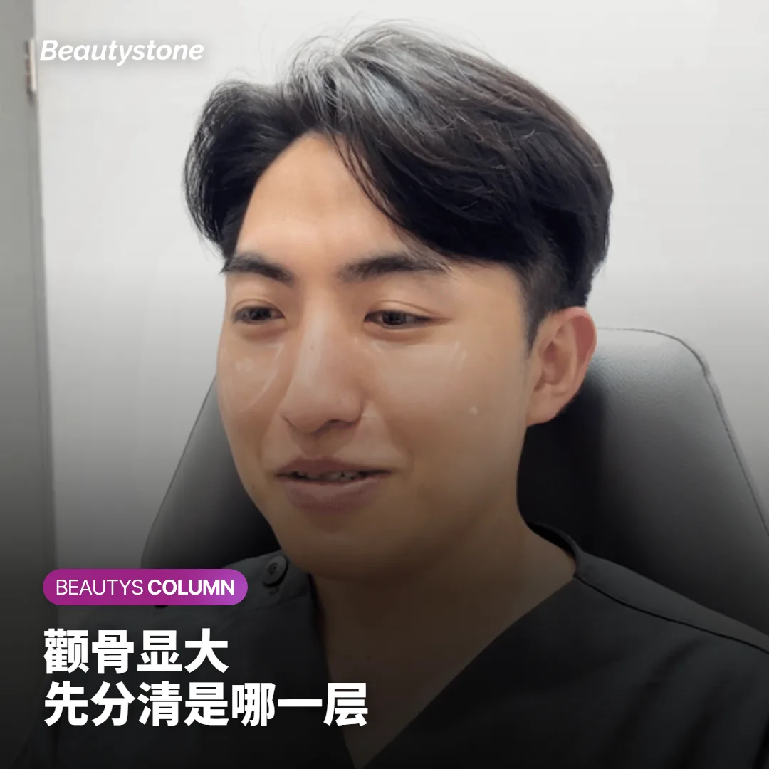 颧骨显大是骨头还是肉?分清三层再决定做不做超声刀