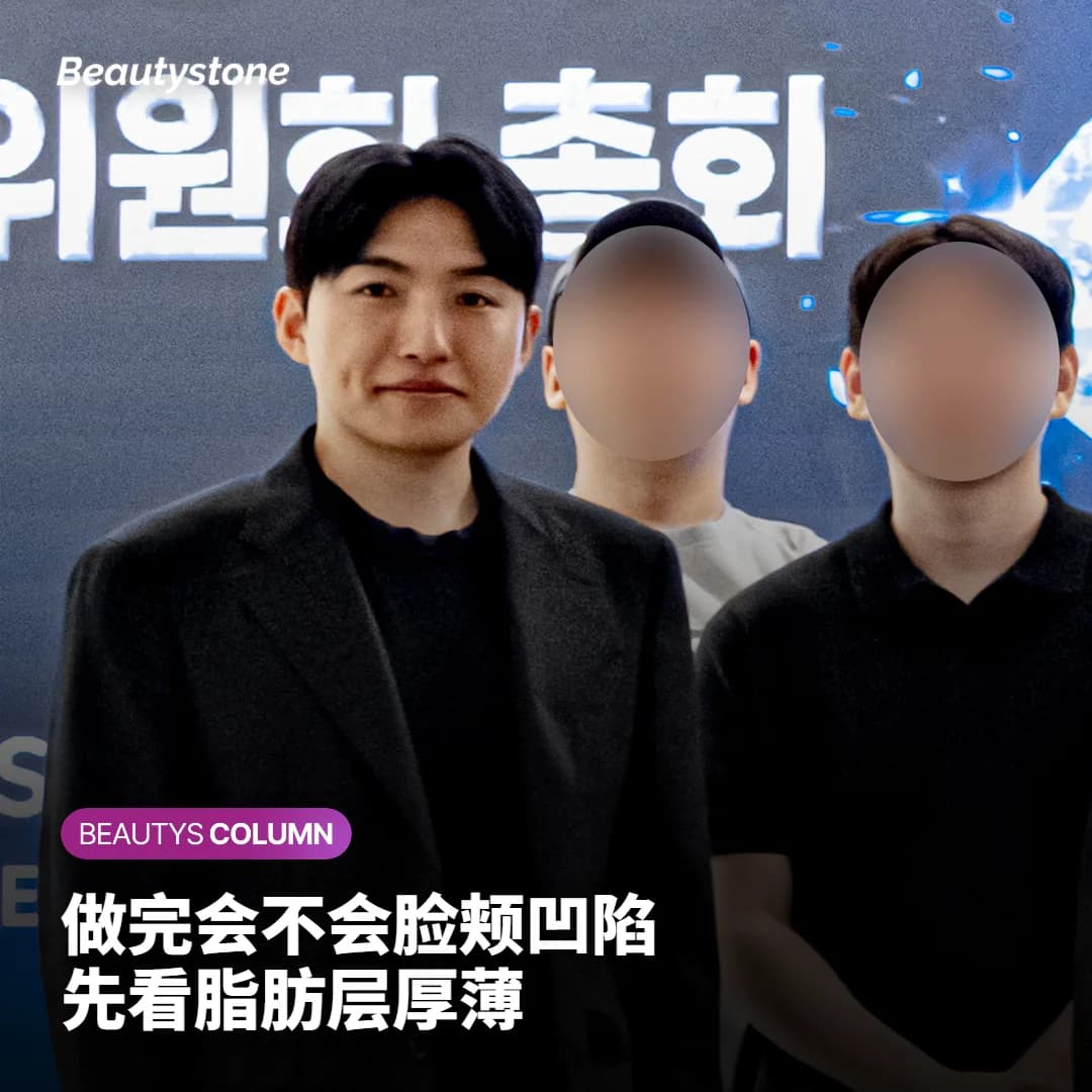 InMode FX 副作用:几天就消的红肿,和脸颊凹陷怎么分