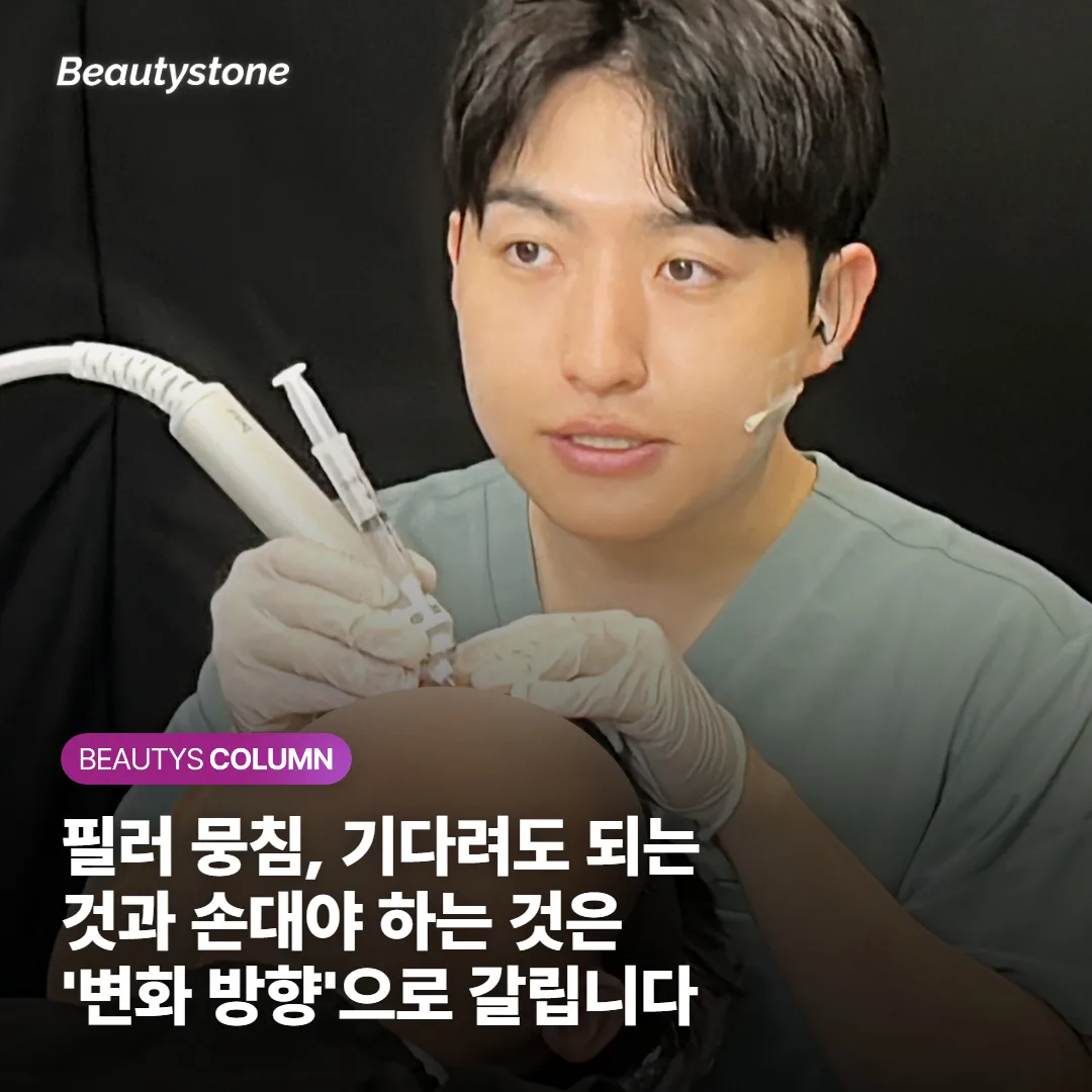 필러 뭉침, 기다려도 되는 것과 손대야 하는 것은 '변화 방향'으로 갈립니다
