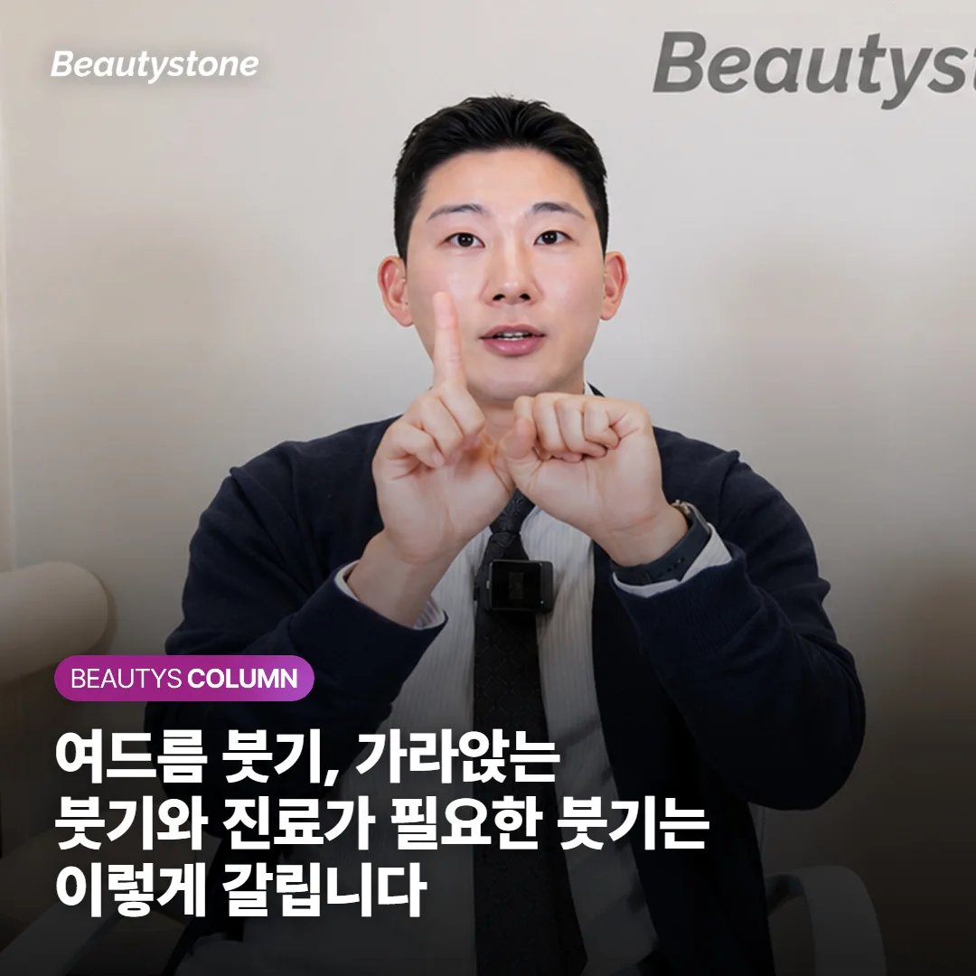 여드름 붓기, 가라앉는 붓기와 진료가 필요한 붓기는 이렇게 갈립니다
