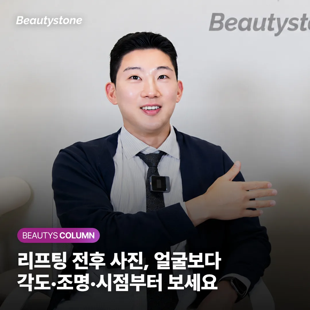 리프팅 전후 사진, 얼굴보다 각도·조명·시점부터 보세요