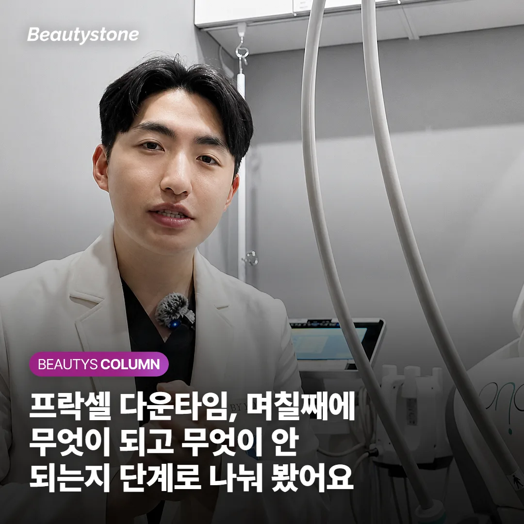 프락셀 다운타임, 며칠째에 무엇이 되고 무엇이 안 되는지 단계로 나눠 봤어요