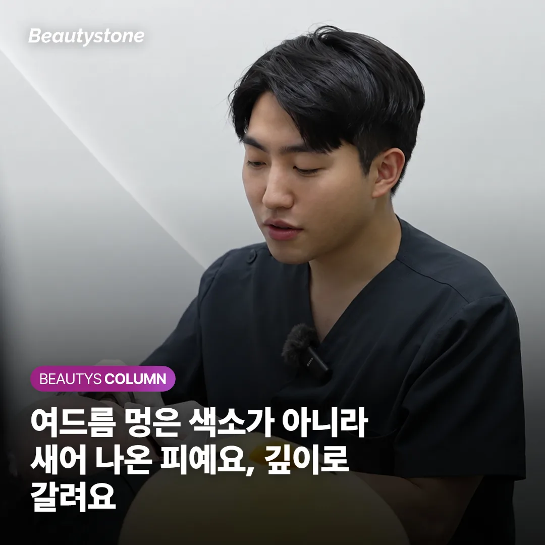 여드름 멍은 색소가 아니라 새어 나온 피예요, 깊이로 갈려요