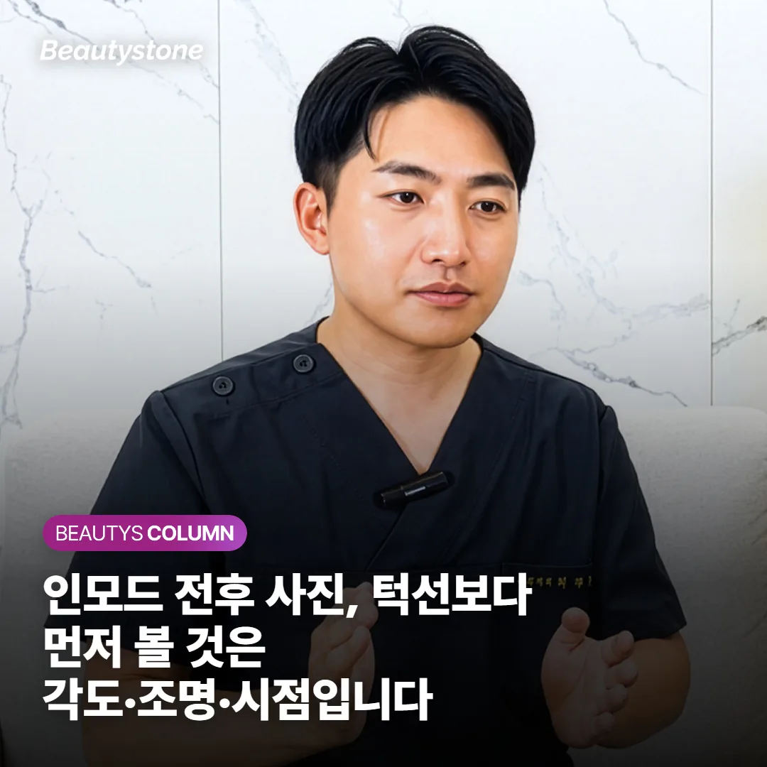 인모드 전후 사진, 턱선보다 먼저 볼 것은 각도·조명·시점입니다