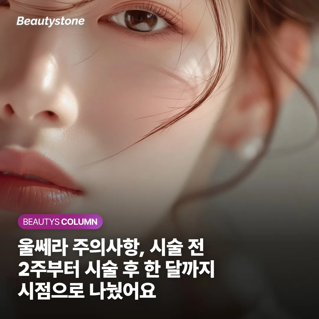 울쎄라 주의사항, 시술 전 2주부터 시술 후 한 달까지 시점으로 나눴어요