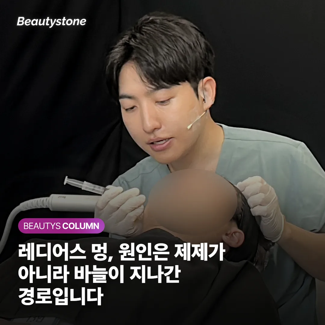 레디어스 멍, 원인은 제제가 아니라 바늘이 지나간 경로입니다