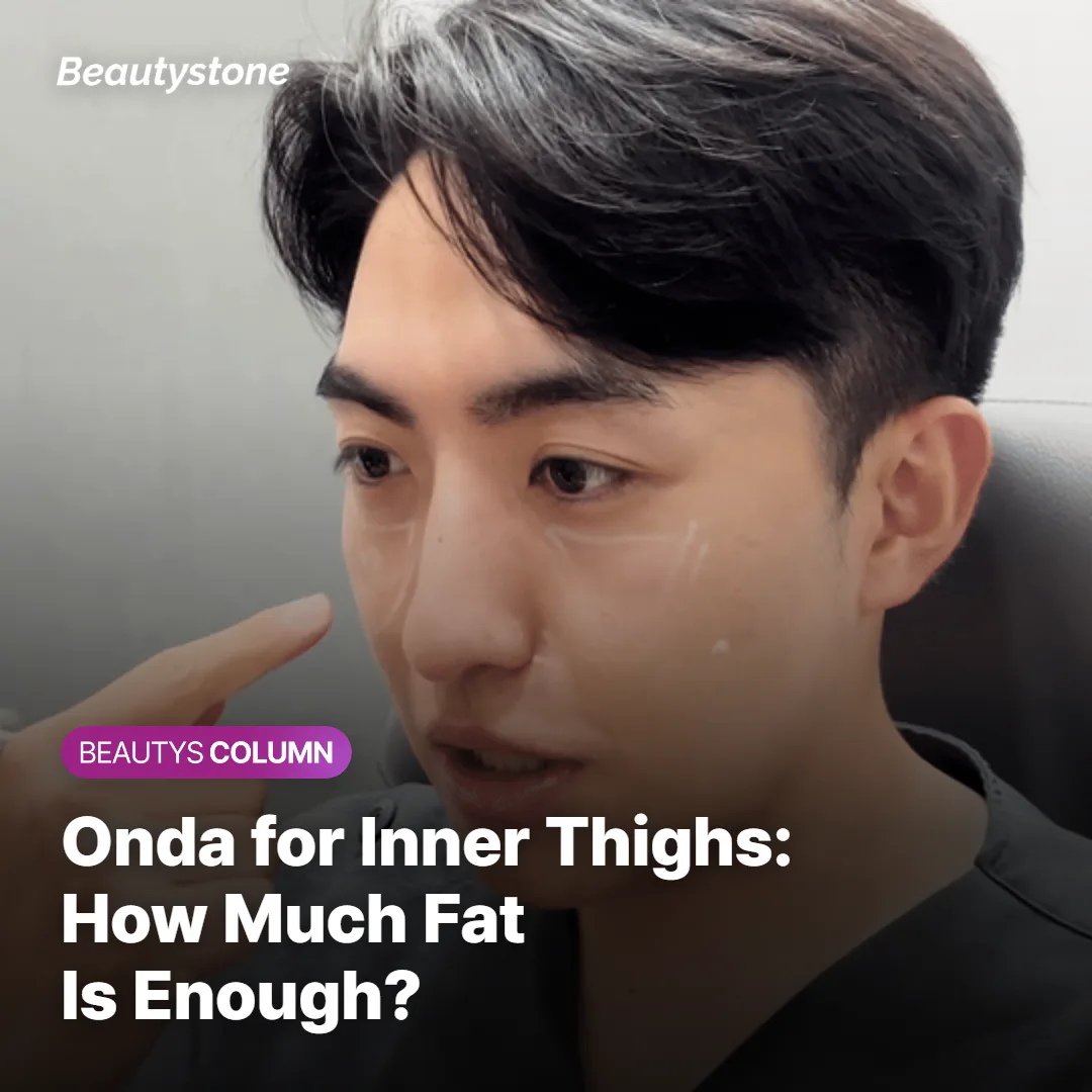 Onda for Inner Thighs: How Much Fat Is Enough?