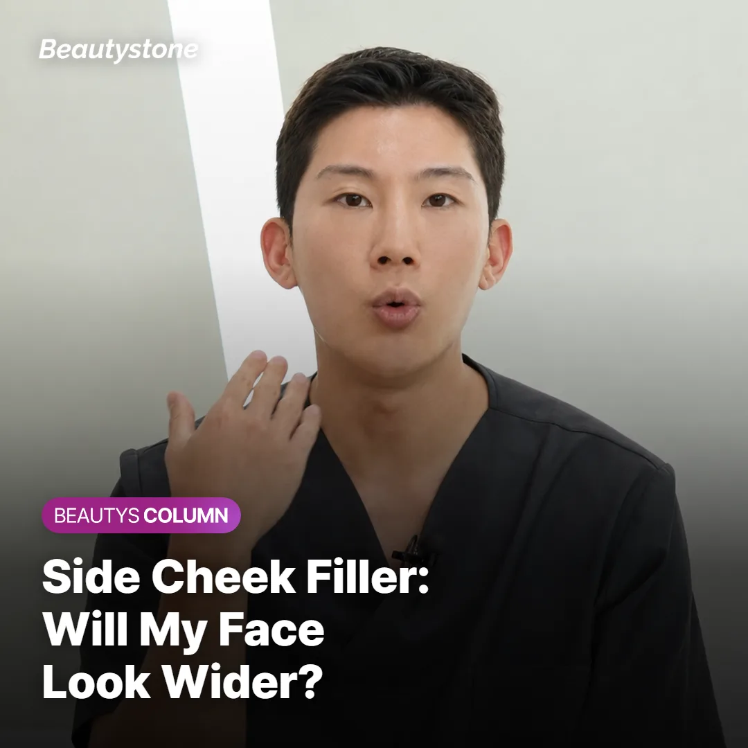 Side Cheek Filler: Will It Make My Face Wider?