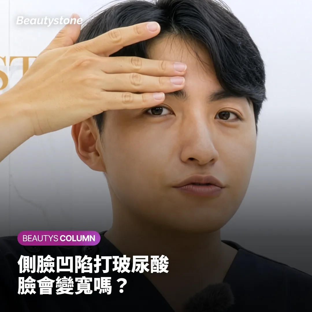 顴骨下凹陷打玻尿酸,臉會變寬嗎?先分清凹陷還是鬆弛